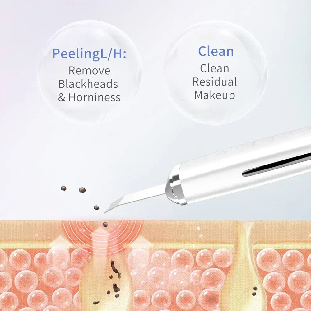 Electric Facial Skin Scrubber Spatula