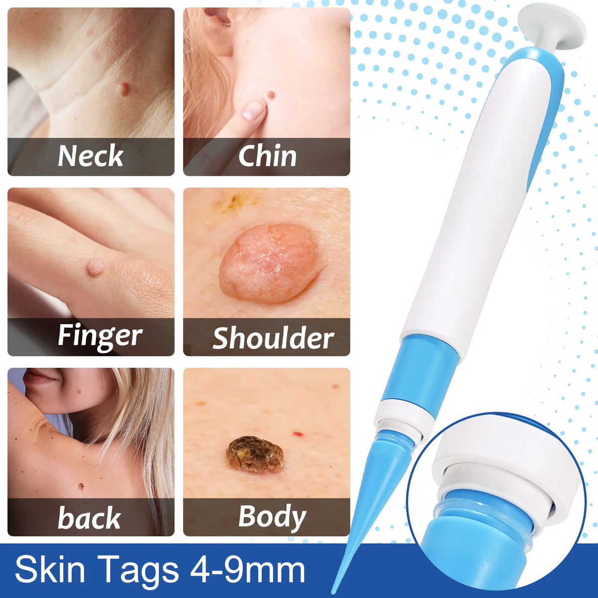 Auto Large Size Skin Tag Removal Tool Kit Painless Mole Wart Removal Pen Body Dot Treatments Remover Beauty Face Skin Care Tools