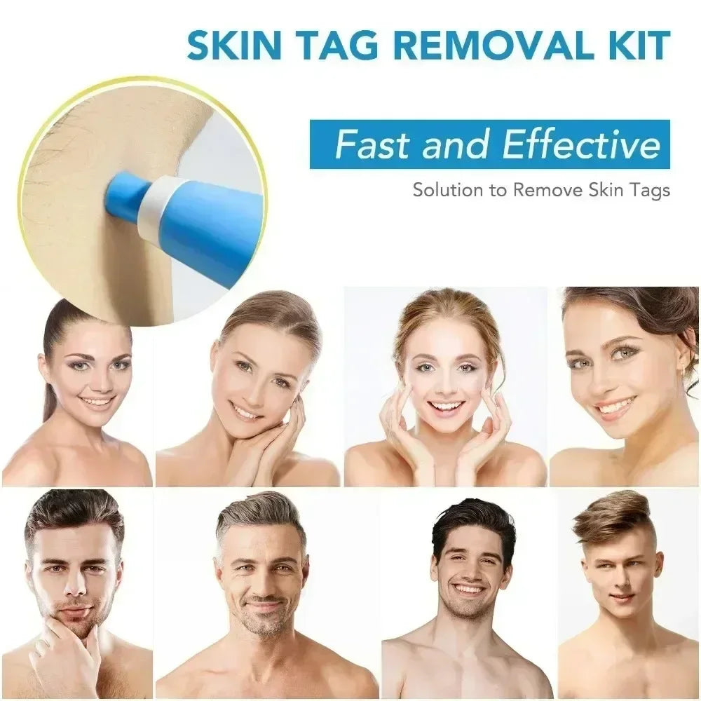 2 IN 1 Painless Auto Micro Skin Tag Removal Kit Adult Skin Tag Mole Wart Remover Device Face Cleaning Skin Care Beauty Tools