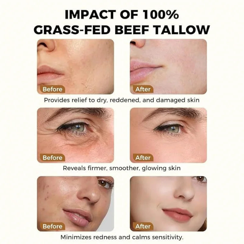 Beef Tallow Honey Moisturizer Cream - Deep Hydration Nourishing Brightening Redness Repair Pore Minimizer for Women Sensitive Dr