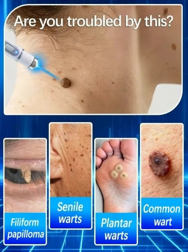 Cosmetic Skin Surface Care Device for Mole Spot Wart and Tag Support