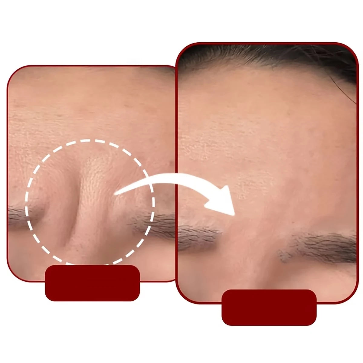 54/30/6 Pieces of Self-Adhesive Sleep Forehead Patches - Reusable Anti-Wrinkle Elastic Patches for the Face, Suitable for Full Face Facial Training, Washable, Sticky and Reusable