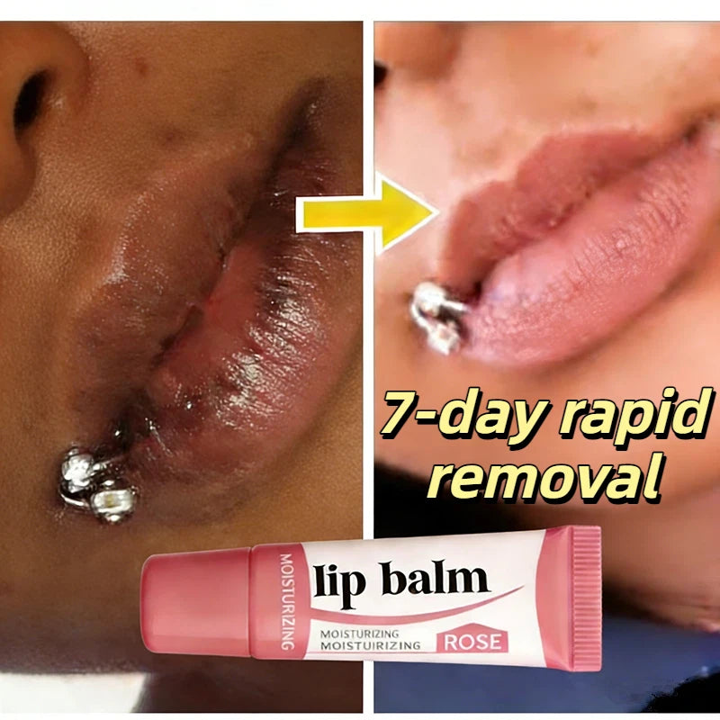 Remove Dark Lip Balm Serum Fast Lighten Melanin Lip Mask Exfoliating Fade Lip Lines Dead Skin Nourishing Repair Lip Care Makeup