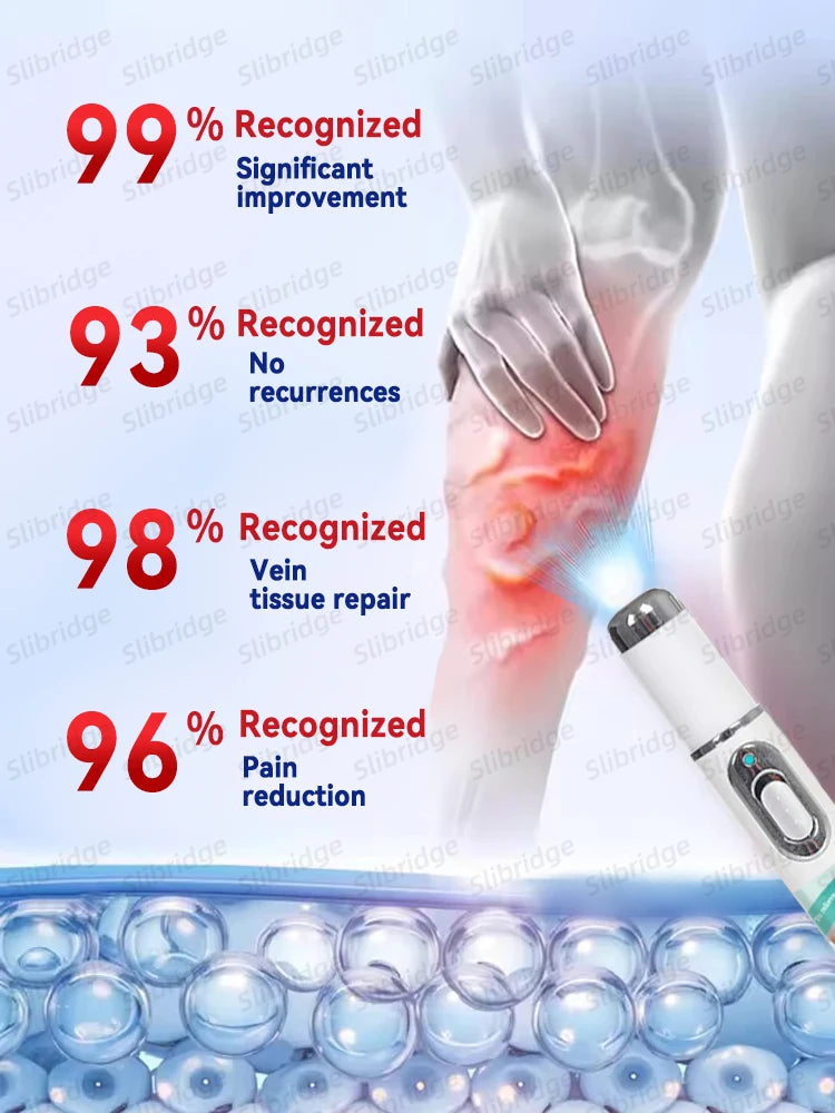 Leg care tool blue laser eliminates varicose veins painlessly